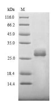 Bovine Coronavirus BCoV Spike Protein (Recombinant 10His, N-terminus)