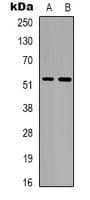 Polyclonal Rabbit anti-Human Alpha Tubulin Antibody (Acetyl-Lys352, WB)