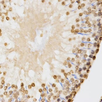 Histone H3 Antibody (Di-Methyl-Lys9)