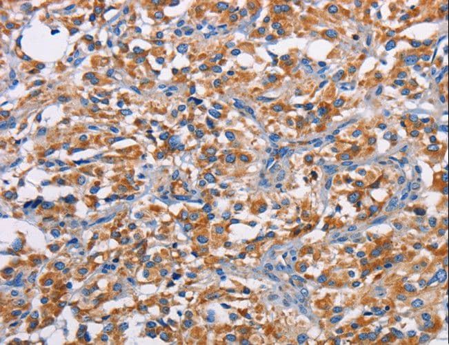 PIM2 / Pim-2 Antibody