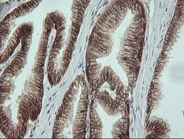CTNNB1 / Beta Catenin Antibody (clone OTI9C1, Carrier-free)
