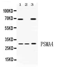 Polyclonal Rabbit anti-Human PSMA4 Antibody (WB)