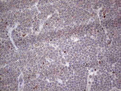 NR1I3 / CAR Antibody (aa1-236, clone OTI1C6, Carrier-free)