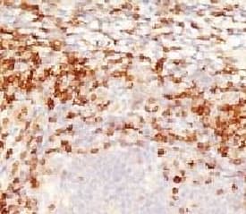 CD5 Antibody (clone CLDA5-1)