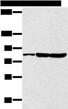 Polyclonal Rabbit anti-Human CCNT2 / Cyclin T2 Antibody (WB)