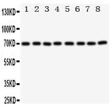 XRCC6 / Ku70 Antibody (aa530-545)