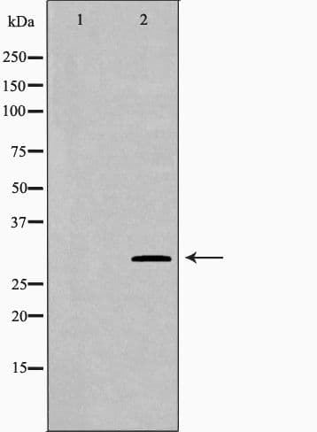 TNFSF5IP1 / CLAST3 Antibody