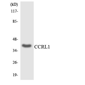 ACKR4 / CCRL1 / CCR11 Antibody (aa47-96)