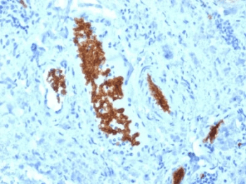 SPTA1 / Alpha Spectrin Antibody (clone SPTA1/1810)