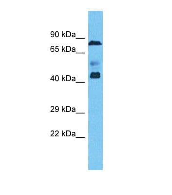 ZNF362 Antibody (aa32-81)