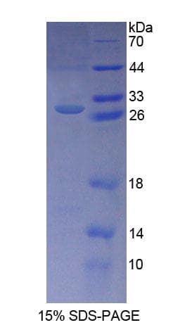 Human KPNA3 / Importin Alpha 4 Protein (Recombinant His-T7)