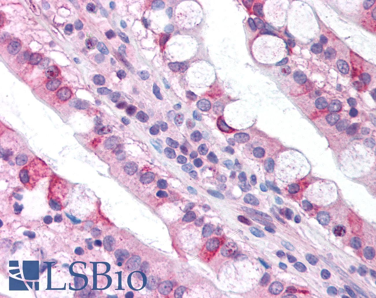 CLDN18 / Claudin 18 Antibody (C-Terminus, HRP)