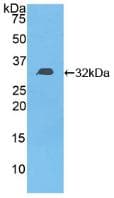 Human DGKE / DGK Epsilon Protein (Recombinant His, N-Terminal)
