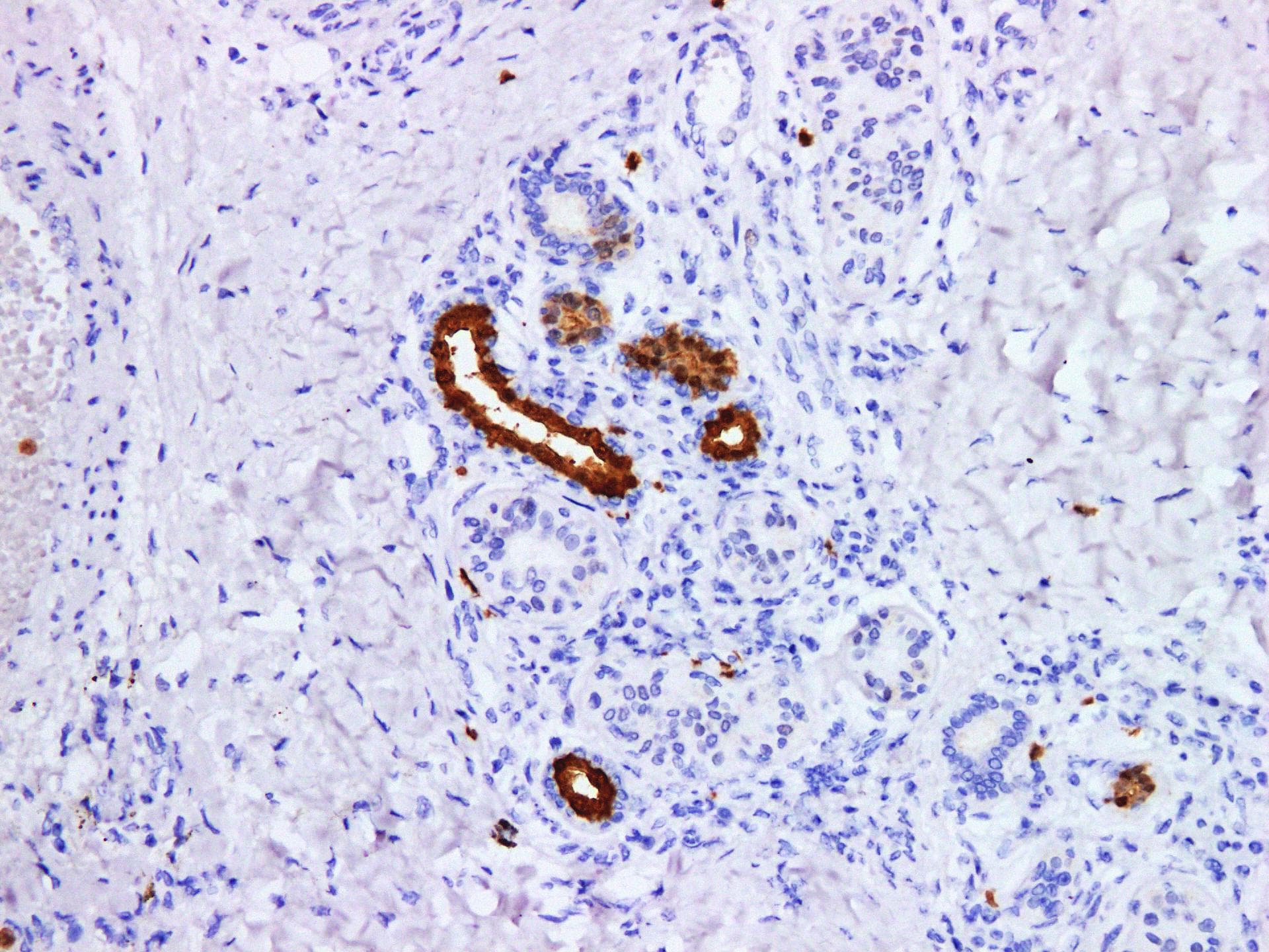 S100P Antibody