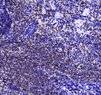 INPP5D / SHIP1 / SHIP Antibody