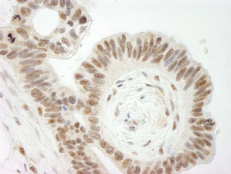 TOP2B / Topoisomerase II Beta Antibody (aa1570-C-term)