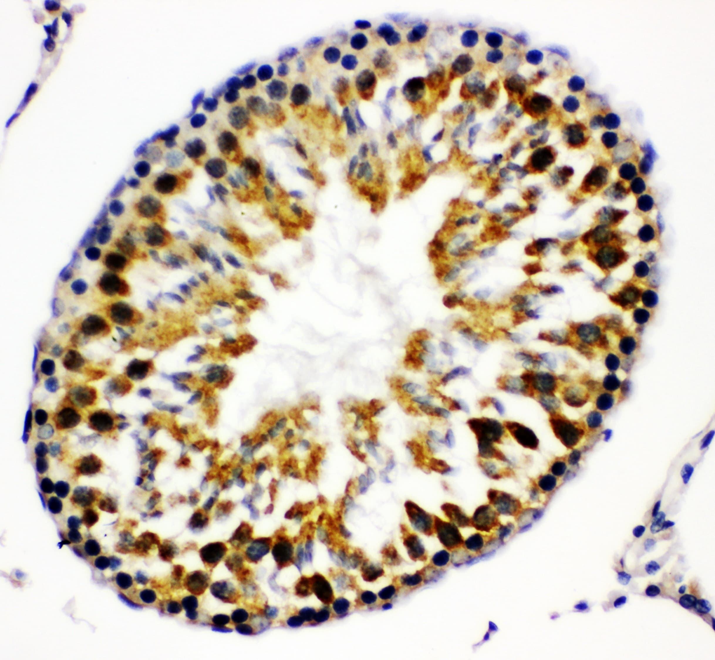 ARRB2 / Beta Arrestin 2 Antibody (aa395-409)