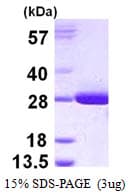 Human GSTT2 Protein (Recombinant His)
