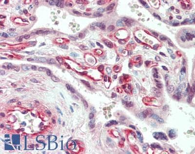 IHC-plus™ PGF / PLGF Antibody (aa120-148)