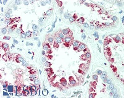 PathPlus™ LYZ / Lysozyme Antibody (clone BGN/0696/5B1)