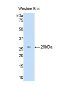 IDS / Iduronate 2 Sulfatase Antibody (aa95-289)