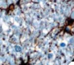 GFAP Antibody (clone G-A-5, Ready-to-Use)