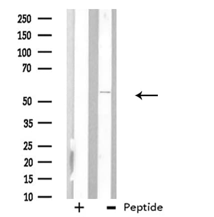 ARFGAP3 Antibody