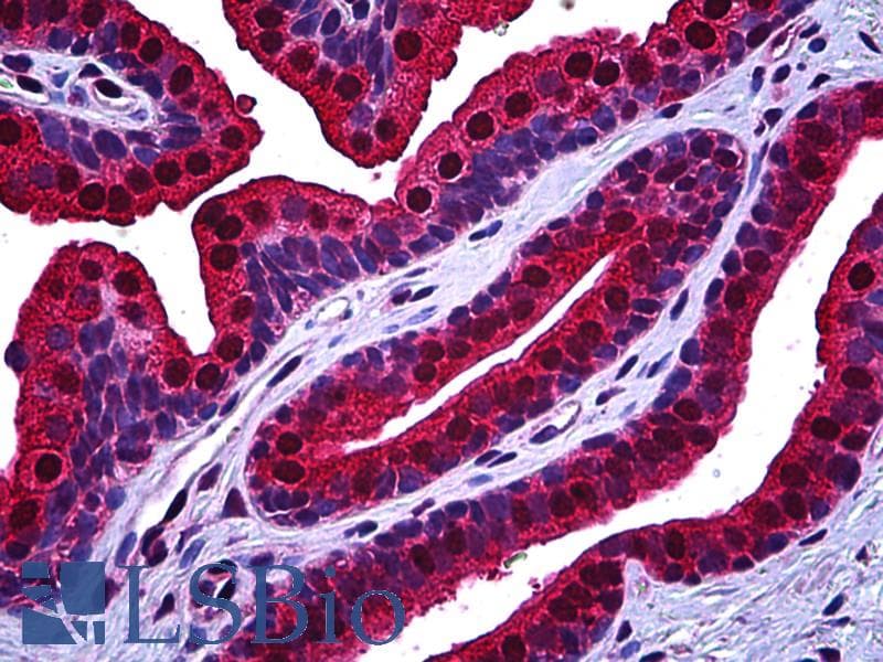 IHC-plus™ VCP Antibody (clone 4A8)
