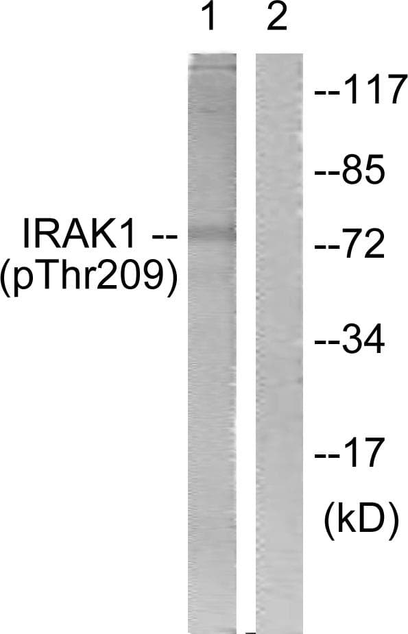 IRAK1 / IRAK Antibody (phospho-Thr209)
