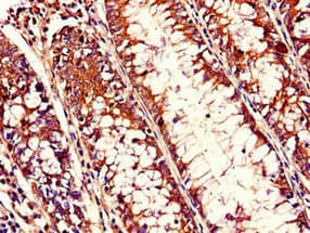 TTF / RHOH Antibody