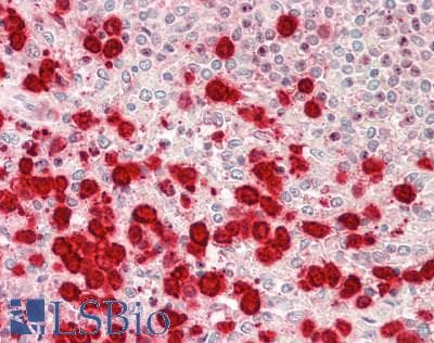 CXCL9 / MIG Antibody (aa23-125)