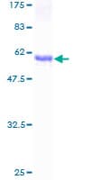 Human EPHA7 / EPH Receptor A7 Protein (Recombinant GST)