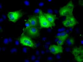 GLUL / Glutamine Synthetase Antibody (clone OTI1F4)