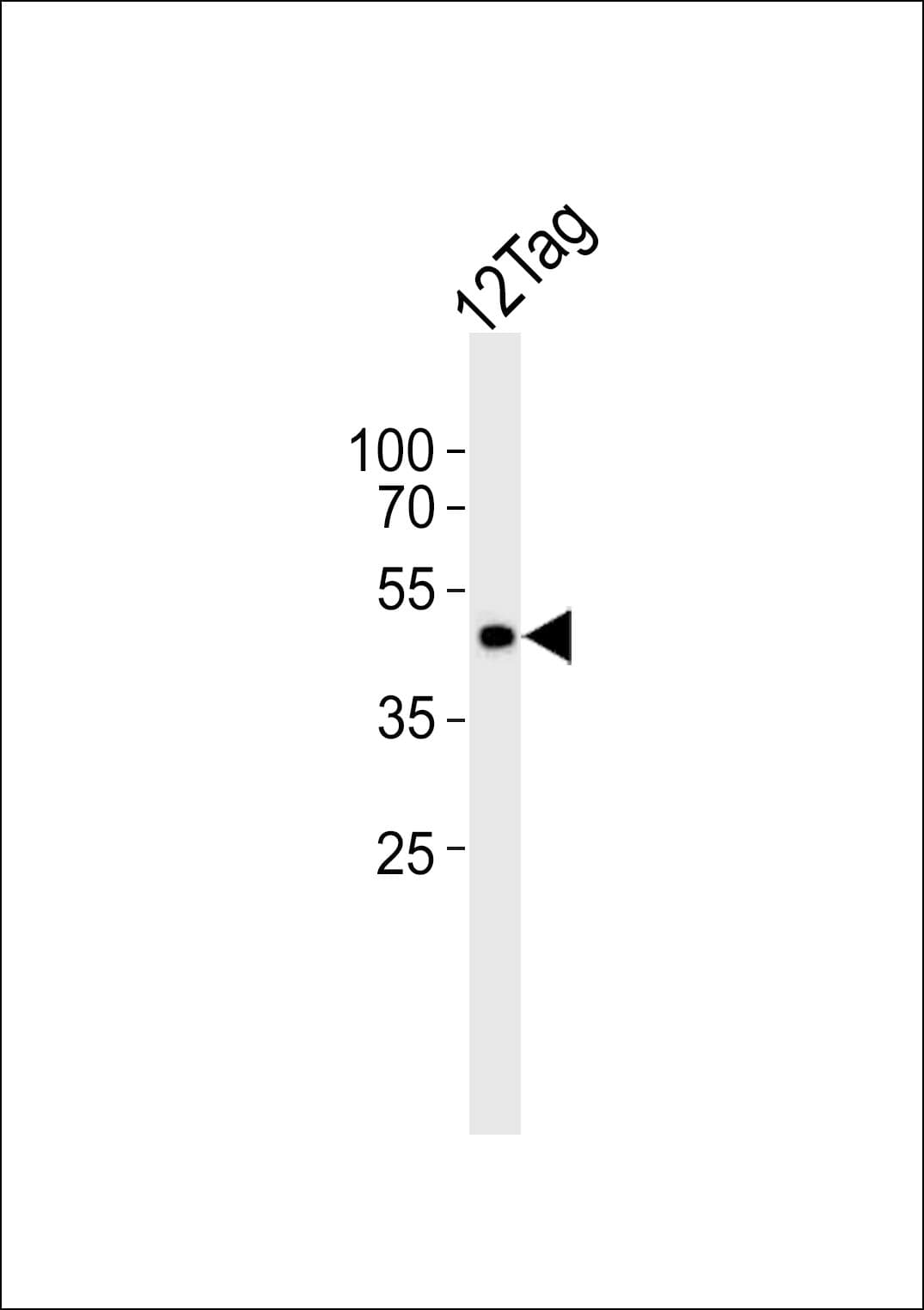 Myc Tag Antibody
