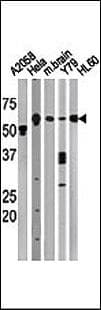 BECN1 / Beclin-1 Antibody (aa210-239)