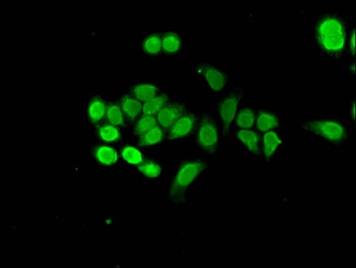 Polyclonal Rabbit anti-Human NUPR1 Antibody (IHC, IF)