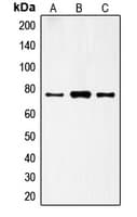 Polyclonal Rabbit anti-Human FSH Receptor / FSHR Antibody (Internal, IHC, WB)