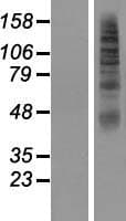 SLC2A11 / GLUT11 Protein (Over-Expression Lysate Myc-DDK (Flag))