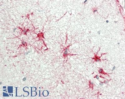 IHC-plus™ OR7C1 Antibody (aa189-238)