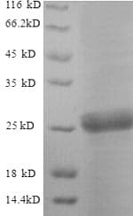 Saccharomyces cerevisiae Neutral Trehalase Protein (Recombinant 6His, N-terminus)