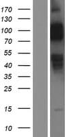Human LDLR / LDL Receptor Protein (Over-Expression Lysate Myc-DDK (Flag))