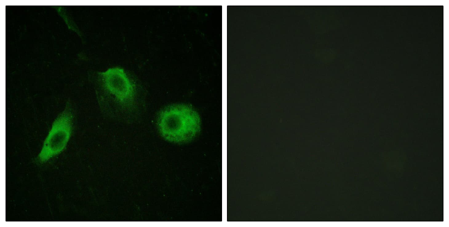 PLCG2 / PLC Gamma 2 Antibody (phospho-Tyr1217)