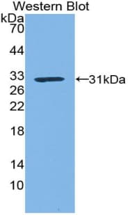 KLK1 / Kallikrein 1 Antibody (aa21-261)