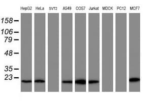 COMMD1 Antibody (clone OTI3B3)