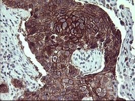 Monoclonal Mouse anti-Human CD44 Antibody (clone OTI5B5, IHC, IF, WB)