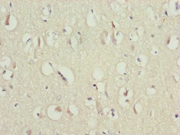Polyclonal Rabbit anti-Human CAMK2D / CaMKII Delta Antibody (IHC)