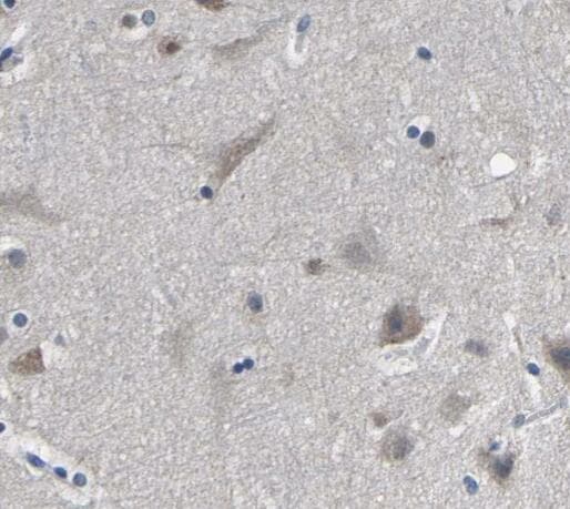 HNRNPC / HNRNP C Antibody