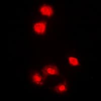 PRKAA1 / AMPK Alpha 1 Antibody (C-Terminus)
