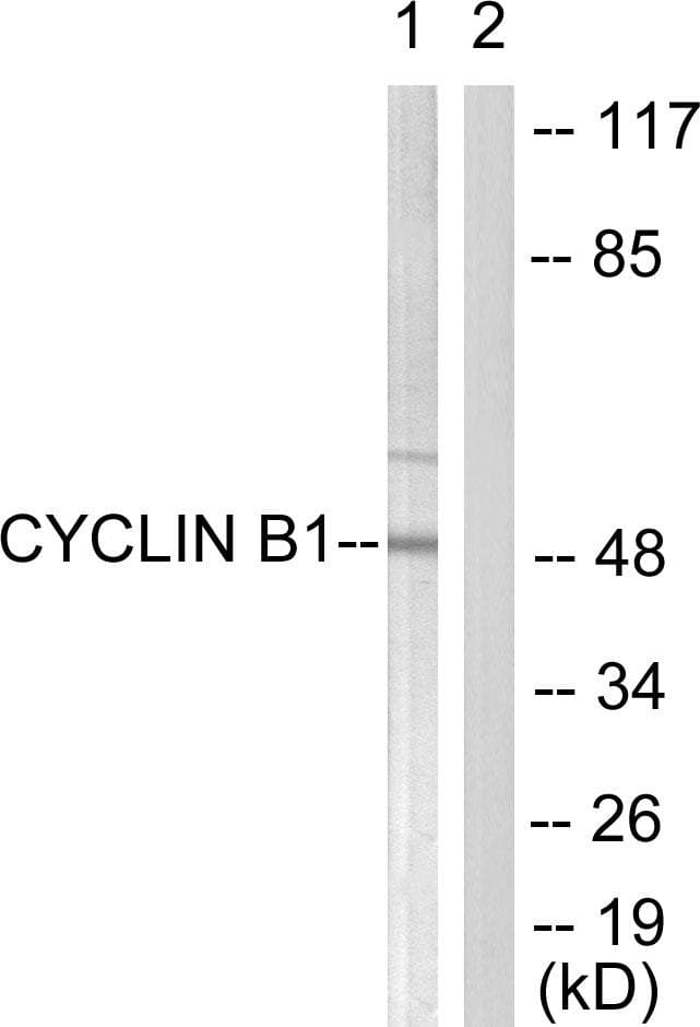 Polyclonal Rabbit anti-Human CCNB1 / Cyclin B1 Antibody (p126, IHC, IF, WB)