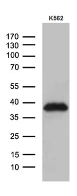 Monoclonal Mouse anti-Human ITM2A Antibody (clone OTI8C3, WB)